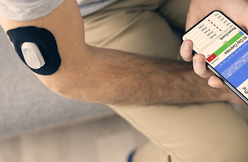 Continuous glucose monitoring