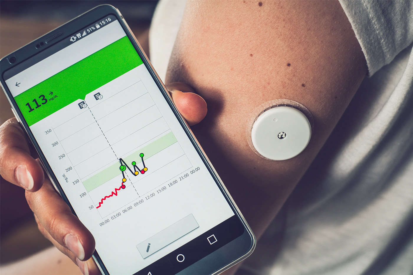 Remote Blood Pressure Monitoring System